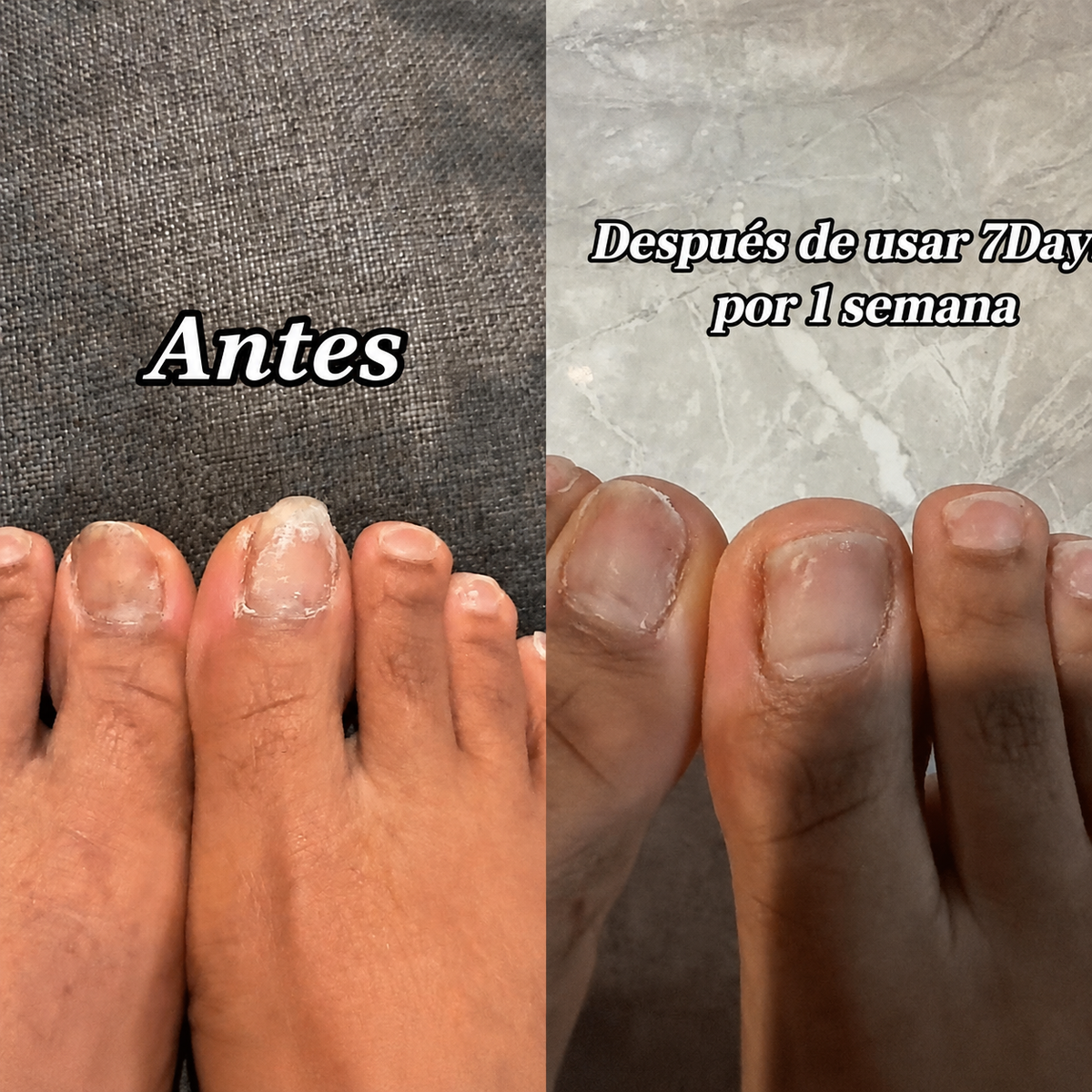 SLOT 6 — Antes y después 3 (vertical, estilo TikTok)