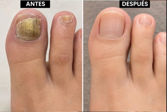 SLOT 5 — Antes y después 2 (vertical, estilo TikTok)